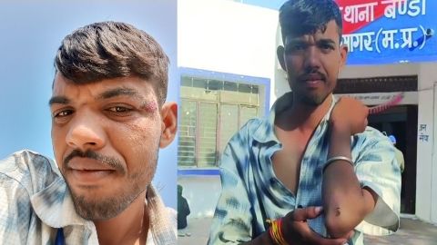 सागर : बच्चों के सामने ड्राइवर की पिटाई : सागर के इस गांव के लम्बरदार का तांडव, स्कूल प्राचार्य पर भी उठे सवाल